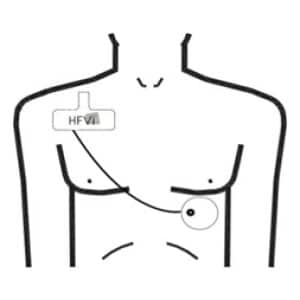HFVi Monitor Sensors