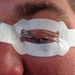 EyePro Eye Occlusion Dressing