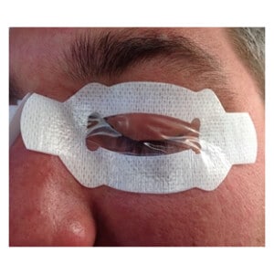 Shows a face with eyelid occlusion dressing applied over eyes